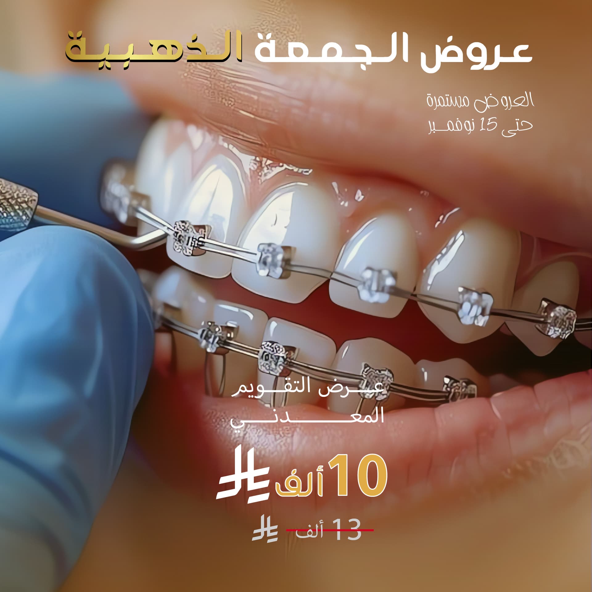 عرض التقويم المعدني